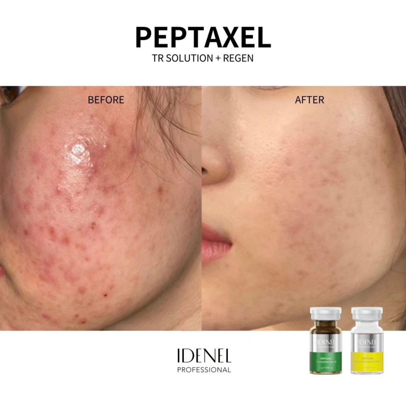 IDENEL dermokozmetika