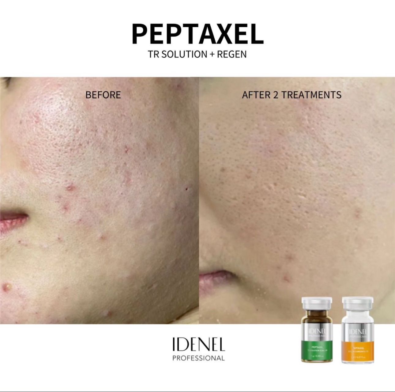 IDENEL dermokozmetika