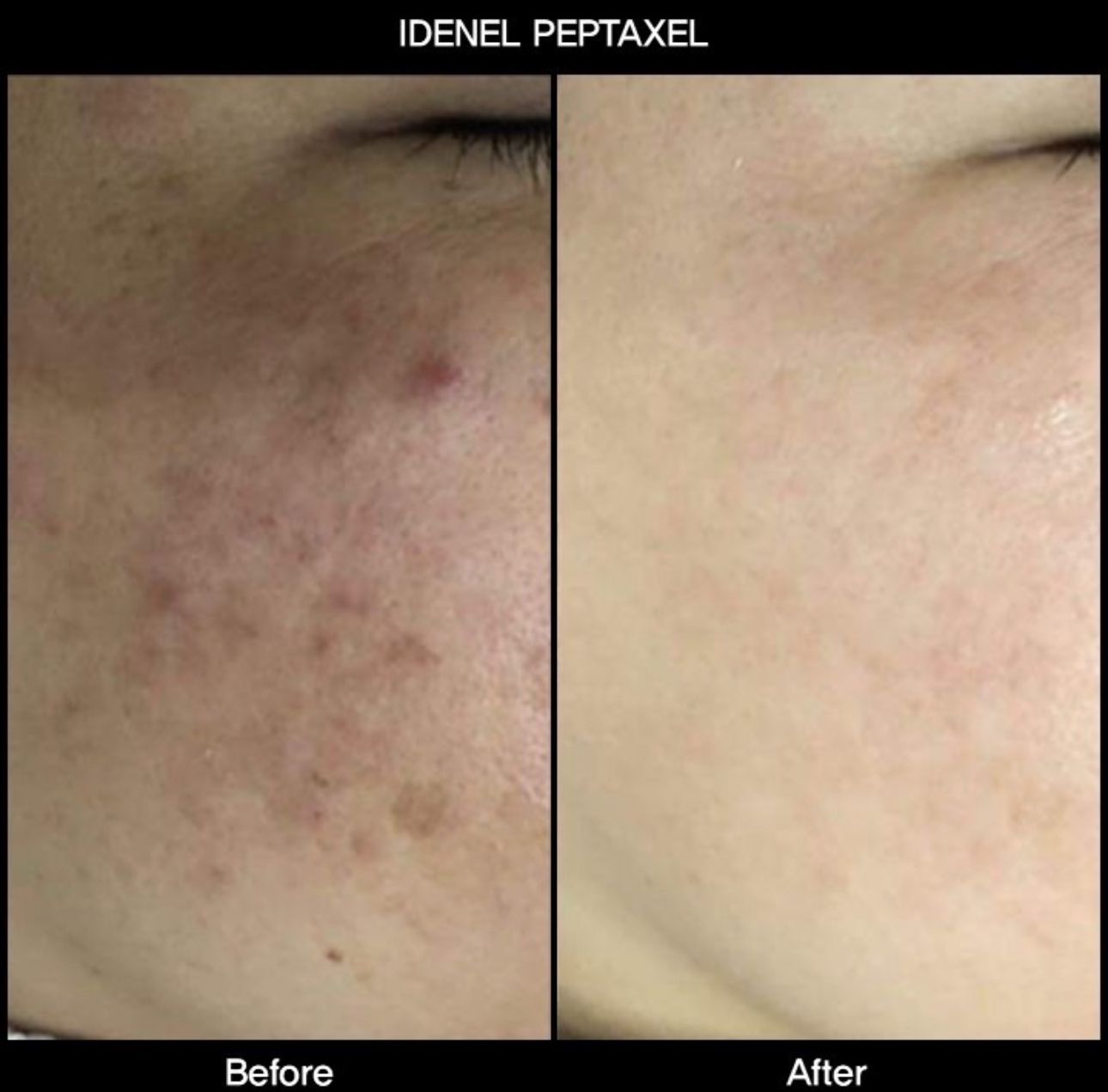 IDENEL dermokozmetika