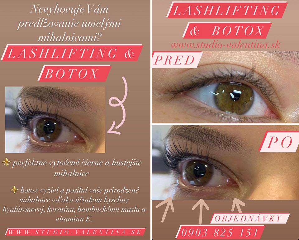 Lash Lifting